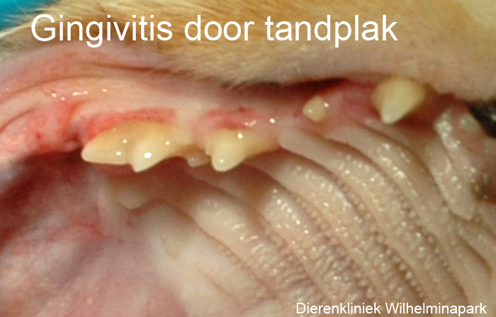 Tandplak kan gingivitis of nog veel erger veroorzaken